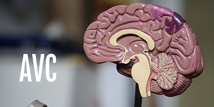 couverture de : Pr&eacute;vention de l'AVC